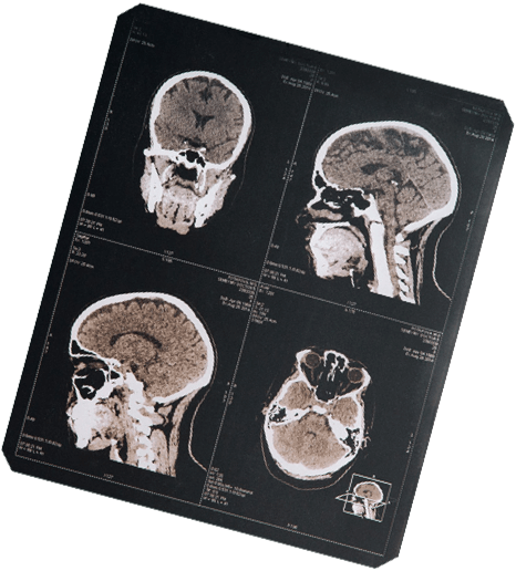 Полное секвенирование генома: расшифровка ДНК человека в генетическом ...